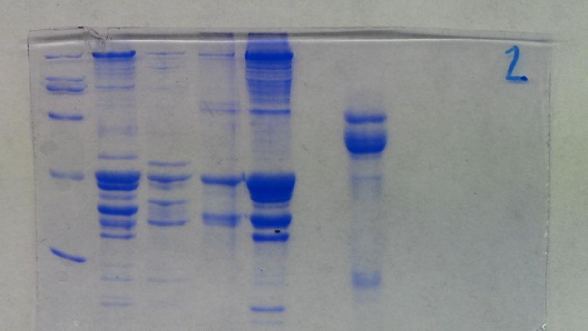 VÃ½sledek rozliÅ¡enÃ­ rybÃ­ch bÃ­lkovin a bÃ­lkovin slin gelovou elektroforÃ©zou.