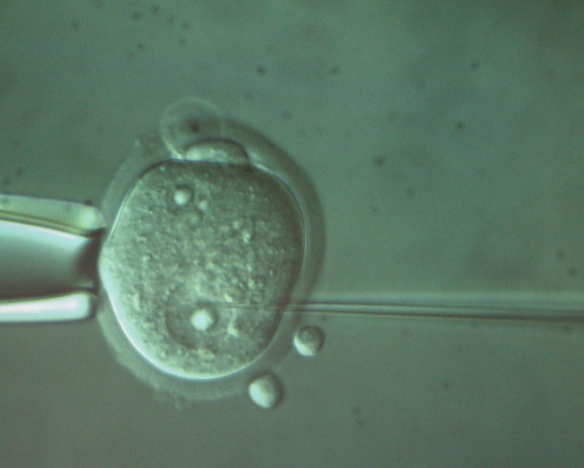 Ãšstav molekulÃ¡rnÃ­ genetiky 2009. V oddÄ›lenÃ­ transgeneze, kde se provÃ¡dÃ­ umÄ›lÃ© oplodnÄ›nÃ­ vajÃ­Äek.